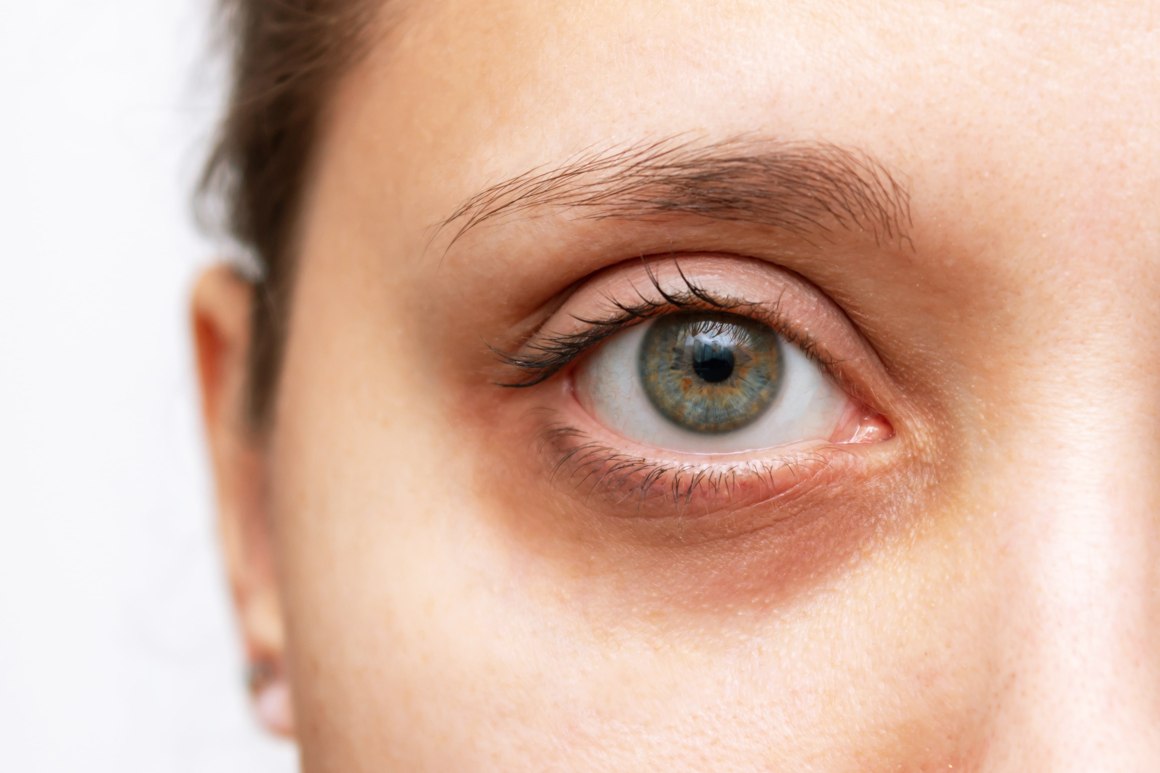 How To Choose The Best Eye Cream for Dark Circles